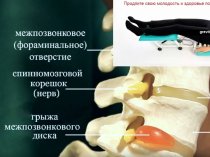 Лечение боли в спине на тренажере для лечения позвоночника Грэвитрин